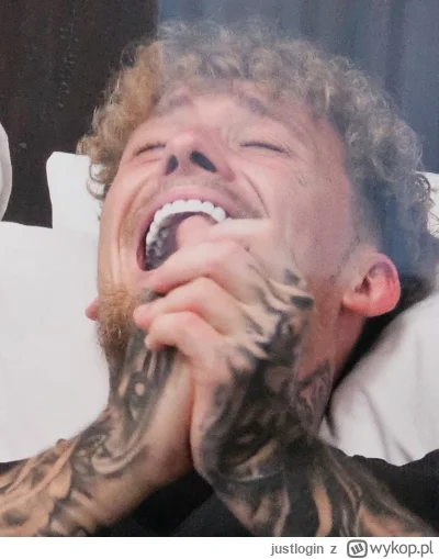 justlogin - O co chodzi z tym Milanem, że ma on od wewnątrz czarne zęby? To są korony...