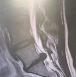 mlody_czyzyk23 - Życie jest przewrotne :(

Lekarz po odpaleniu płyty z mojego rezonan...