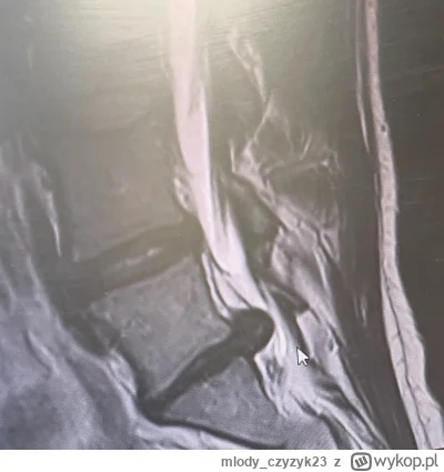 mlody_czyzyk23 - Życie jest przewrotne :(

Lekarz po odpaleniu płyty z mojego rezonan...