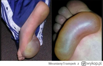 WeunianyTrampek - Chyba nigdy nie rozchodzę tych butów 
#humorobrazkowy