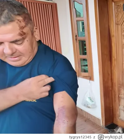 tygrys12345 - #raportzpanstwasrodka Grubas spocony przegrał z grawitacją. Pijany, nać...