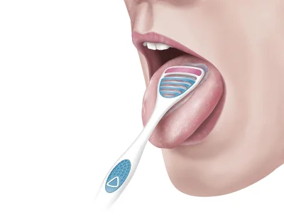 arinkao - @dongio: Język sie myje, po każdym myciu zębów, choćby szczoteczką przejedź...