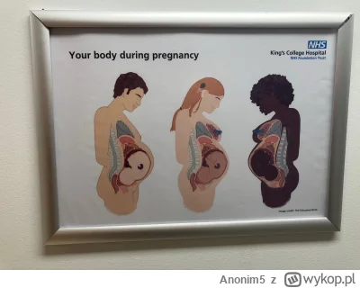 Anonim5 - #przegryw a wy widzieliście kiedyś mężczyzne w ciąży?