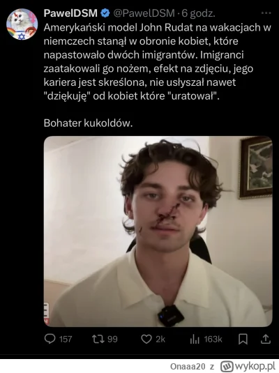 Onaaa20 - #rozowepaski #niebieskiepaski #pieklokobiet #pieklomezczyzn #simp #spermiar...