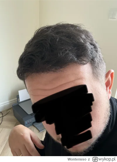 Wontensso - Mój update po 6 miesiącach od przeszczepu. Gdyby ktoś był zainteresowany ...
