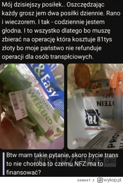 sawes1 - Czyli to nie choroba, ale NFZ powinien zapłacić? Może mi to wytłumaczy jakiś...