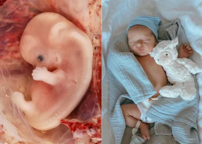 CrazyZdzich - >można dziecko oddać, wiele par latami się stara i z chęcią adoptuje no...