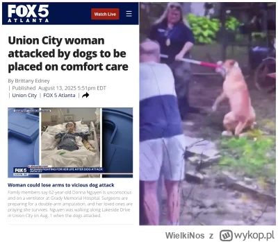 WielkiNos - Kobieta sobie spacerowała ulicą kiedy zaatakowało ją nagle 5 pitbulli jak...