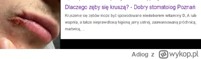 Adiog - malo kto wie ale gej mial opryszczke po lizaniu 60 letniej milficy, a teraz k...