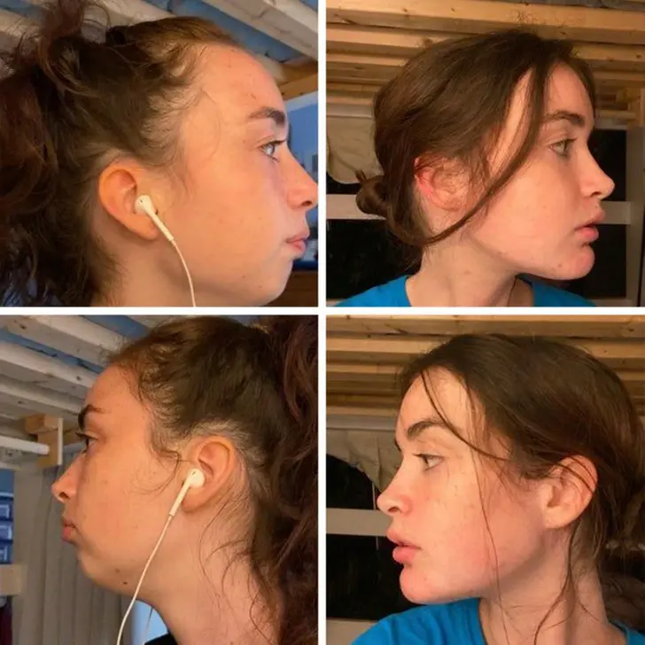 Pasterz30 - W jakim wieku wg Was jest sens jeszcze robic dla efektów wizualnych opera...