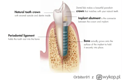 Orbiter01 - @Orbiter01: Implanty są lepsze od zębów.