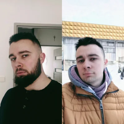 dawidm999 - Siema, jak oceniacie? golić czy zostawić? jak lepiej xD
Edit: bo dziś mia...