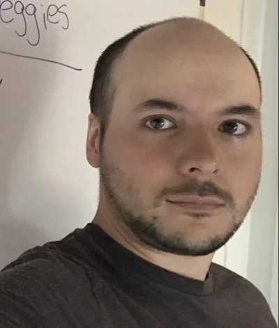 pepe998 - @PietnascieOjroZaWpis: nie bez powodu ma zawsze czapke ( ͡° ͜ʖ ͡°)