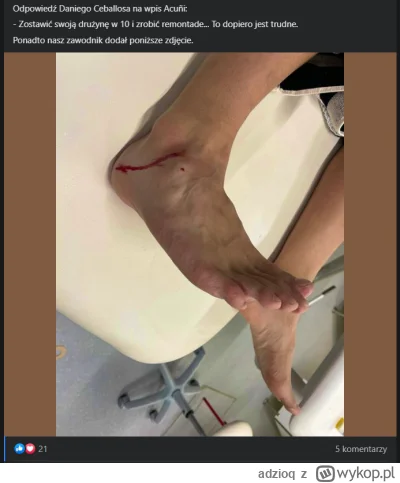 adzioq - @ObslugaRadomskiegoLotniska: Ceballos miazdzy argentynskiego psa