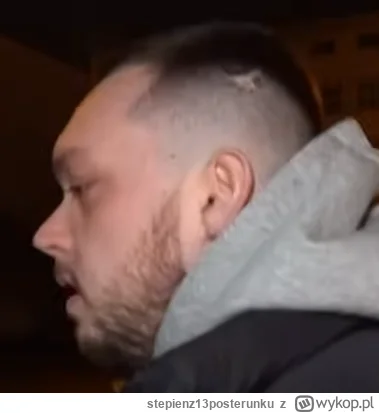 stepienz13posterunku - Ile IQ może mieć osoba z taką budową czaszki?

#inteligencja #...