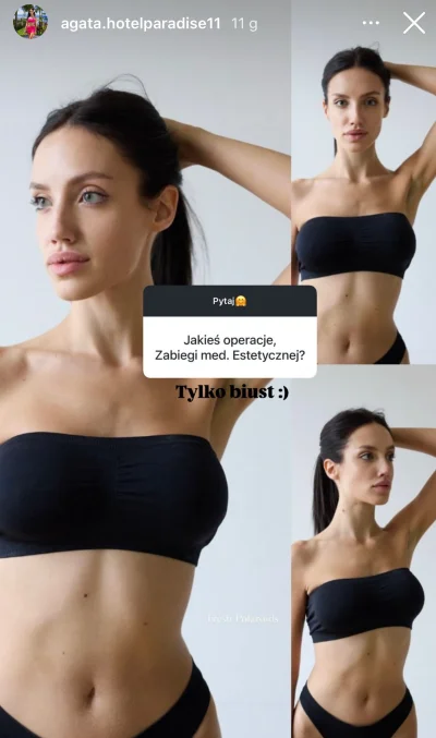 amanda12 - #hotelparadise

To powiększanie ust nie liczy się jako zabieg? Średnio mi ...