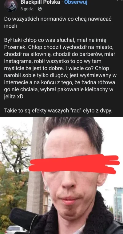 Lolenson1888 - @Brutus66: Warto przypomnieć, bo to historia wyjątkowo przygnębiająca.