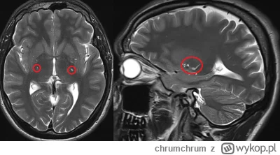 chrumchrum - @dr_Batman: Dzięki za odpowiedz. Korzystając jeszcze z okazji zapytam: m...