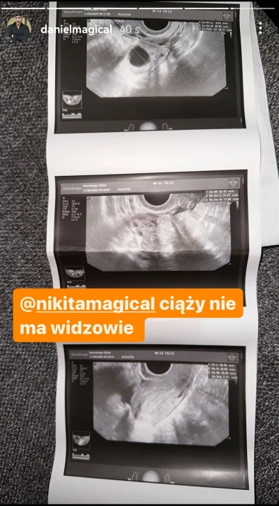 Repoorter - Ciąszy nie ma ficofie

#danielmagical