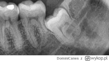 DominiCanes - @T__J: 2 byla wyrywana, wczesniej (tez dolna) byla 1 
@Elec tyż prawda