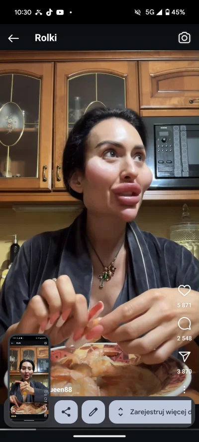 b0dyload - Uczulenie na owoce morza, najgorzej :(
IG