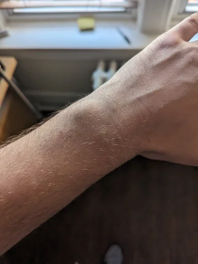 Runaway28 - #przegryw chuop ma cienki nadgarstek. Ktoś wie jaki to jest pill?( ͡° ʖ̯ ...