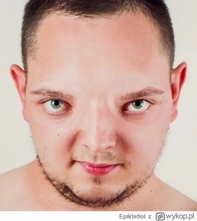 Epiktetlol - Okazało się, że wyniku powikłania podczas usuwania stulejki Daniel nie m...