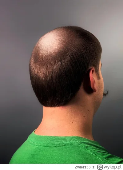 Zwierz33 - Nowa moda barberska dla łysaków na 2025 (ಠ‸ಠ) 
Na mnicha (ง ͠° ͟ل͜ ͡°)ง 
C...