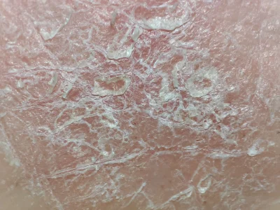 Konrad2114 - lubię sobie robić zdjęcia tej swojej skórze