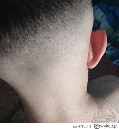 Zwierz33 - @szarley: 
jak nie jebniesz się na łyso to nie jesteś w stanie się ostrzyc...