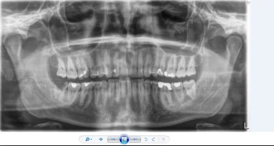 mateuszdinozaur - #stomatologia #dentysta #gownowpis #niebieskiepaski #rozowepaski #l...