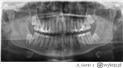 JI_Gorki - Zęby do oceny
Jak źle jest? Idę do dentysty za tydzień i chcę się przygoto...