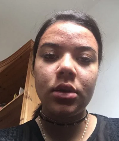 eXwykopek - @adelek192: 3maj