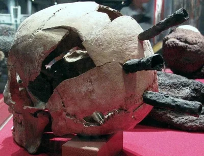 cheeseandonion - A skull with three crossbow bolt wounds from the Battle of Visby, Go...