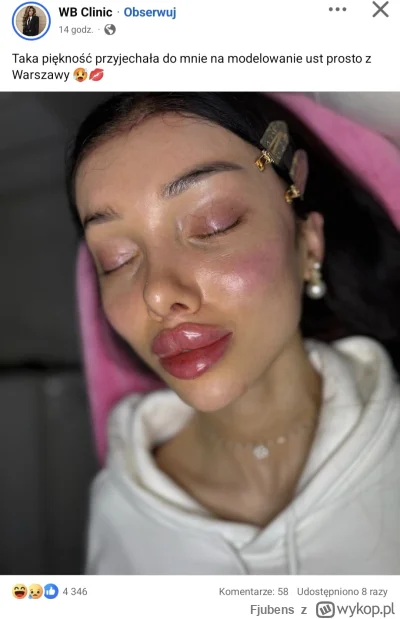 Fjubens - Dlaczego kobiety to sobie robią? 

#logikarozowychpaskow #looksmaxing #logi...