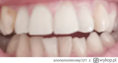 anonanonimowy321 - Przed