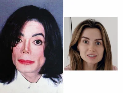 2339 - jeszcze pare operacji i bedzie wyglądać jak michael jackson

#wersow #youtube