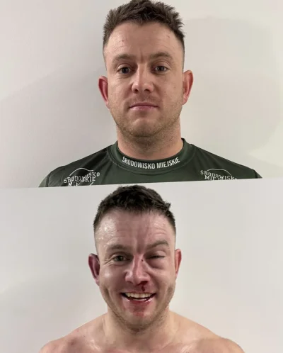 Teemcio - @christian-huygens: @Mavs_atencjusz oko jak Gołota po walce z McBridem xD