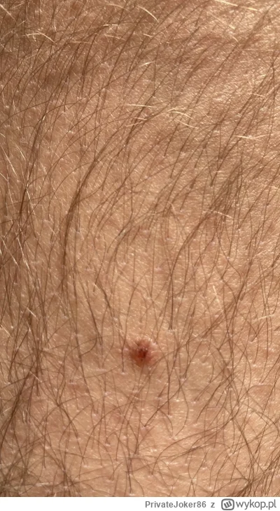 PrivateJoker86 - Jakieś dwa tygodnie temu po powrocie z wakacji zauważyłem, że na jed...