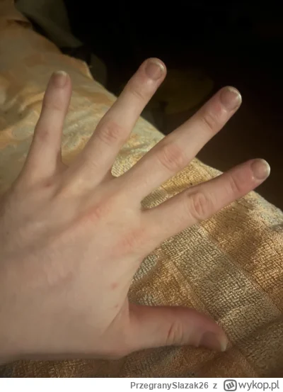 PrzegranySlazak26 - #przegryw czy mam houpską czy bardziej babską ręke. Jak myślicie?