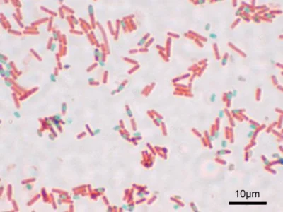 tojestmultikonto - #tojestmultikonto #ciekawostki #mikrobiologia

ENDOSPORY

Znaczeni...