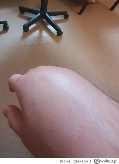 majkel_dzekson - Lekarz czy przejdzie?