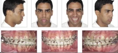 Dawid-01100 - @Arutam2002: Ja mam progenie i muszę operacyjnie zrobić wszystko plus w...