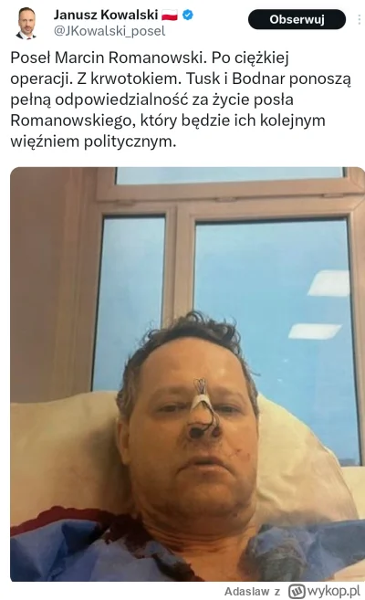 Adaslaw - Czy na podstawie poniższego zdjęcia (wykonanie tamponady nosa, widok z okna...