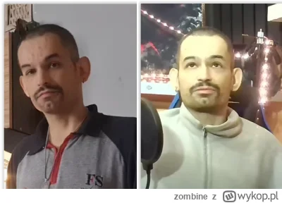 zombine - @Melinaos: Nie bój żaby, kostucha zanim go wyzerowała trochę go pomęczyła. ...