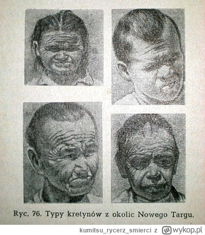 kumitsurycerzsmierci - >oczywiście że góral, co za przypadek ( ͡º ͜ʖ͡º)

@huopisko: