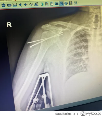 saggitarius_a - Zostałem iron manem!

SPOILER

#zalesie #silownia #mirkokoksy #mikrok...