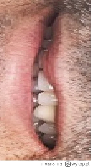 llMarioll - @KebabZostrymSosem: