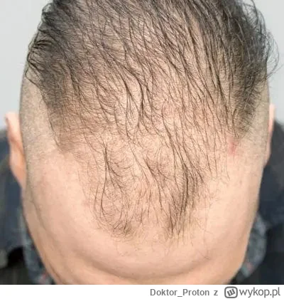 DoktorProton - >@mirkoanonim: A dlaczego nie spróbowałeś coś działać, gdy ten cholern...