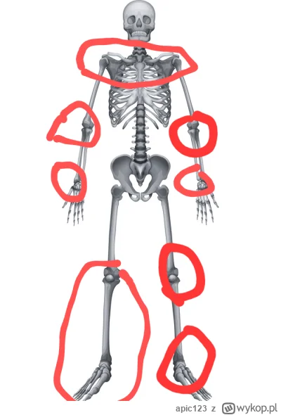 apic123 - Mirki pomóżcie, czuję dyskomfort i ból w zaznaczonych miejscach, wszystkie ...